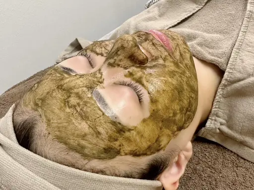 【minimo限定】ニキビ・肌荒れ徹底ケア🌿肌質改善ハーブピーリング✨特別価格¥5,500