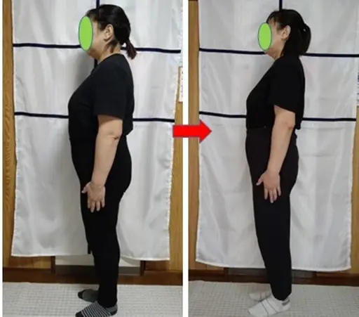 本気でダイエット体験施術＋ダイエットへの説明