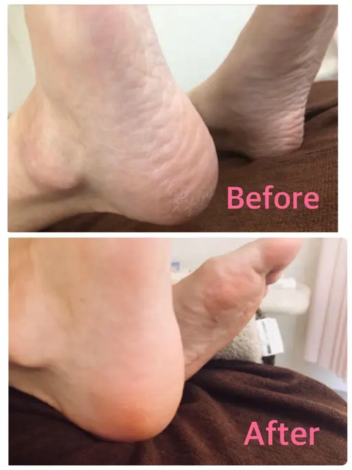 【40代からの足元リセット】かかとガサガサ卒業✨足裏角質ケア