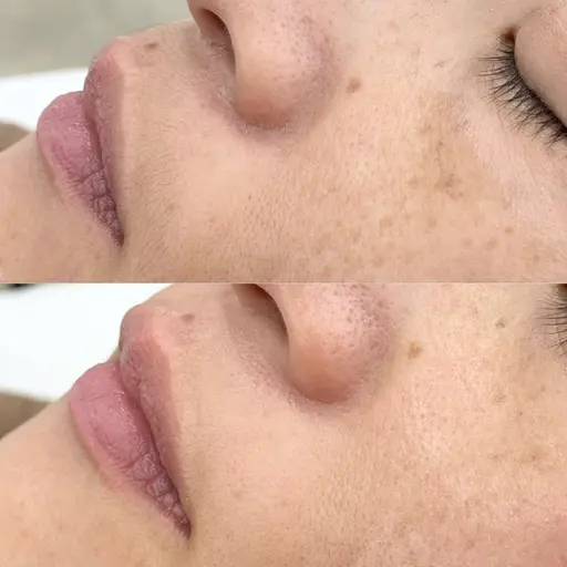 肌が綺麗になるフェイスワックス