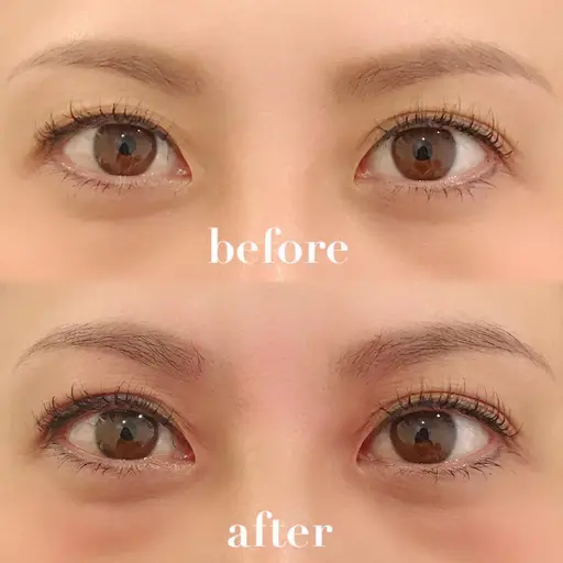 アイストレッチ💆‍♀️