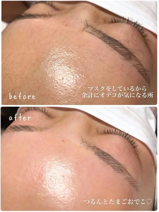 プラスメニューに！部分ワックス脱毛（おでこ、鼻、口周り、もみあげ）各3300→165(