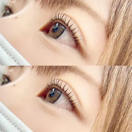 フラットラッシュ