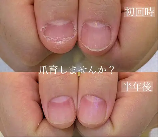 爪育(小爪さん・深爪さん・噛み癖)美爪になりたい方❣️一緒に爪育しましょう✨