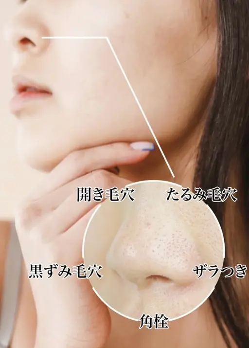 肌質改善したい方💎【オススメ】超音波イオン洗浄×ビタミンC導入