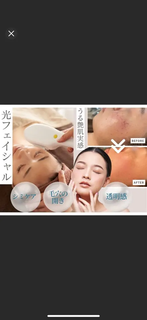 【ミニモ限定】日にち限定！7/7 7/8 17日、27日　うなじ脱毛＆光フェイシャルで後ろ姿美人に✨