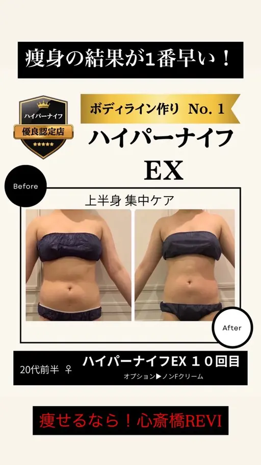 【当日予約‼️先着3名限定】半身ハイパーナイフEX🔥31,900円→9,570円‼️ 驚きの変化を体感してください✨