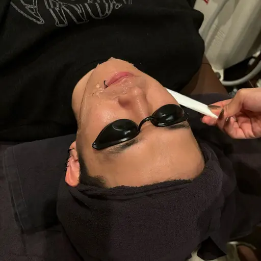 本日限定🉐【光脱毛】美肌全身脱毛（顔＋VIO込み）メンズ➕レディース対応