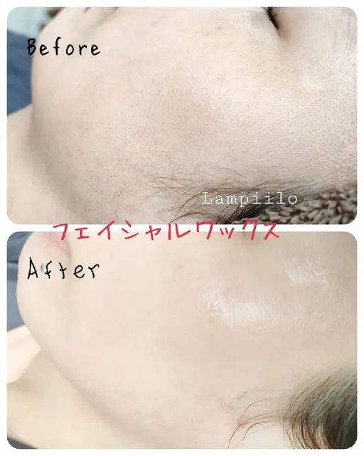 フェイシャルワックス(顔全体・パック付き)