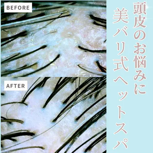 モニター価格🌿発根セラピーヘッドスパ🌿筋膜リリース(EMS)×🫧韓国式水光ジェットインフュージョン(エアバリ)🫧