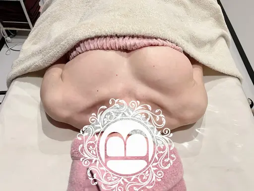 仙台人気No.1【メスを使わない豊胸ミラクルバストプレミアム】