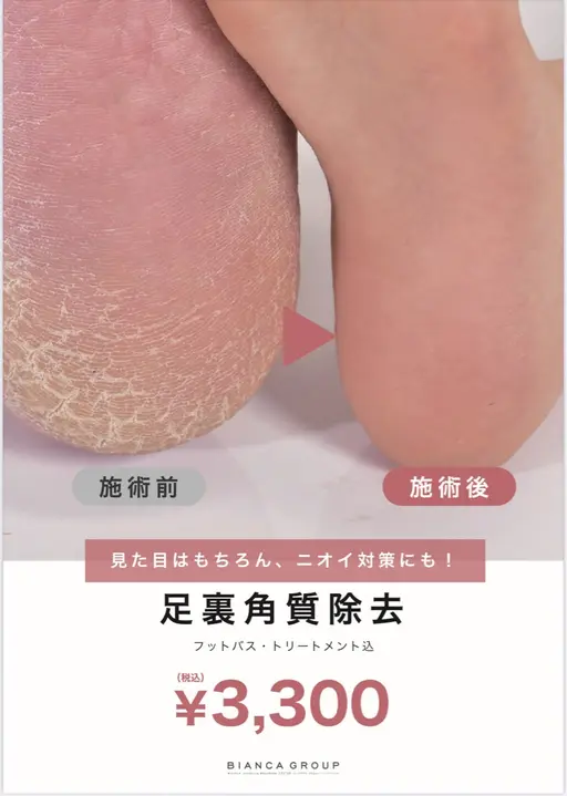 【トリートメント付き】🫧フットバス付き角質ケア🫧