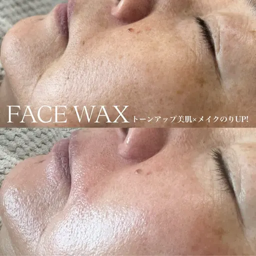 🌼オススメ🌼顔脱毛で手触りつるつる艶肌フェイスワックス(全顔ワックス・保湿パック仕上げ)