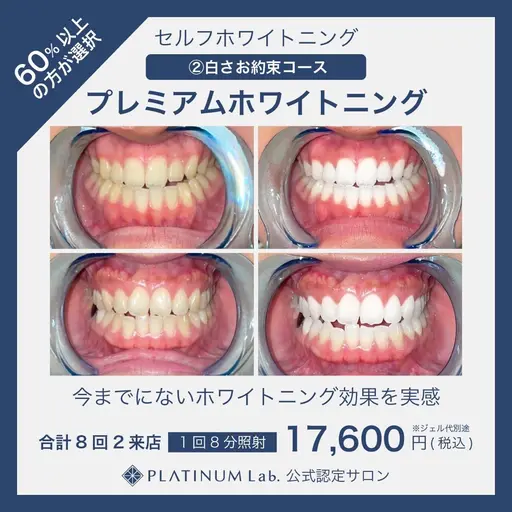 【初回限定・白さを極める】真っ白お約束･ プレミアムホワイトニング❣〈合計 70分照射 2 来店〉❣