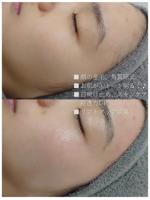 1日空有⭕️【フェイスWax🫧】お顔のいらない産毛、角質をワックスで除去💖¥1,100※日時指定あり