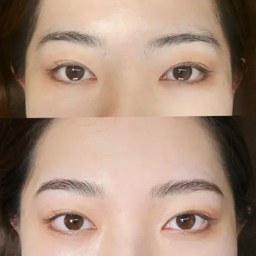 ハリウッドブロウリフト