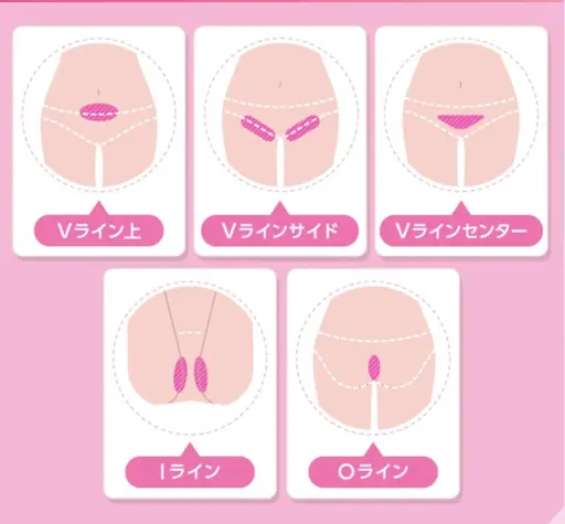 20日限定💫VIO脱毛剃毛付💫デザイン自由💫最新機器でとにかく抜ける！目指せ自己処理いらずなツルツル肌💫