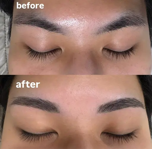 ハリウッドブロウリフト