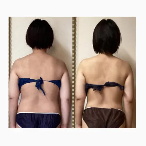 骨格から姿勢・痩身・デトックス◎全身骨格調整×筋膜リリース×リンパ90分体験価格16,500円→11,000円