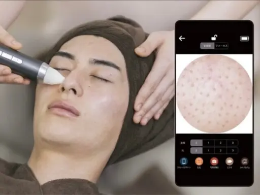 【人気No. 1】毛穴の黒ずみ撃退