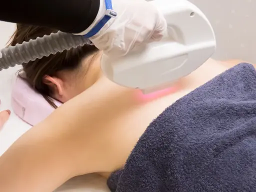 女性全身脱毛(顔+VIO込み)