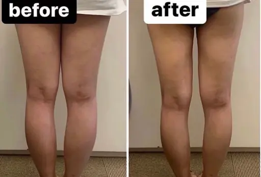 お試し【痩身】60分