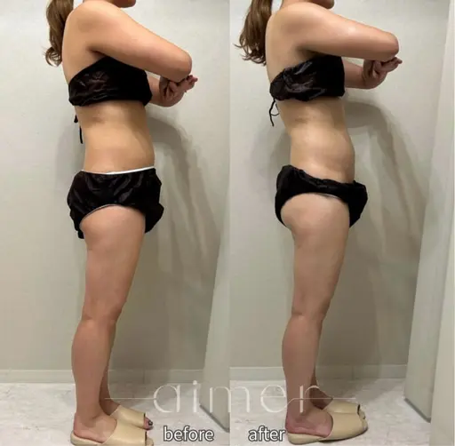 【12月限定🔥】全身ハイパーナイフEX+リンパマッサージ70分‼️