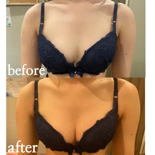 ❄️12月限定❄️最新バストケア体を温めながらEMSをすることにより、爆乳へ冬に大人気！ぜひ一度お任せください😊