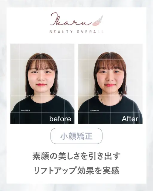 【大人気！】初回限定☆. むくみ・エラ張り♪ 小顔矯正+ヘッドスパ+顎関節調整 30分 ¥7000→¥3500