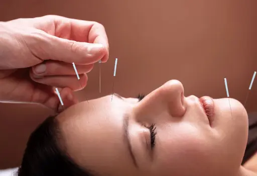 【OPEN記念⭐️口コミ必須】美容鍼45分