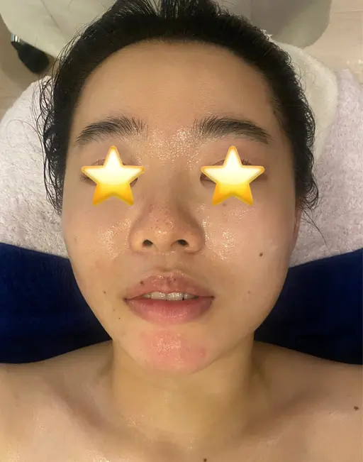 ⭐️オープン記念メニュー⭐️アドバンスコース 50分+エイジングオプション付でお顔も身体もスッキリ😍