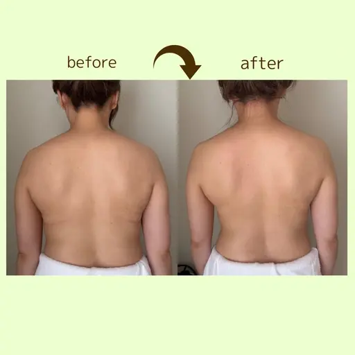 猫背改善‼️巻肩改善‼️首を細く長く小顔に見せる✨背中美人✨【50分➕足湯ほぐし10分】