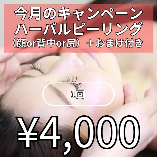 ハーブピーリング（顔or背中orお尻）　1回4000円