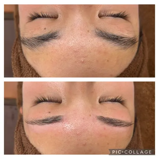 眉毛WAX脱毛