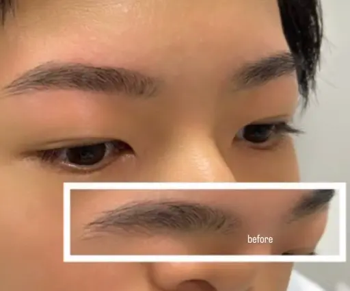 美眉ワックス脱毛