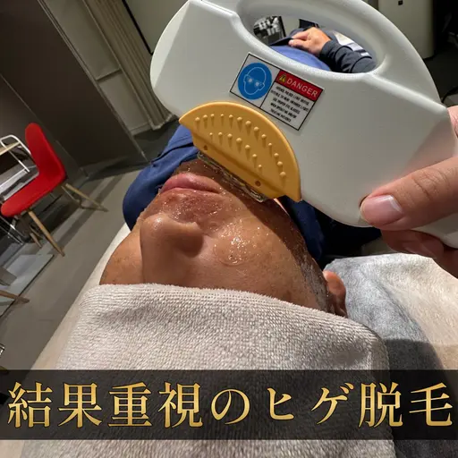 【プロ施術】清潔感を整えるメンズヒゲ脱毛 《脱毛範囲》口周り/頬/アゴ裏/