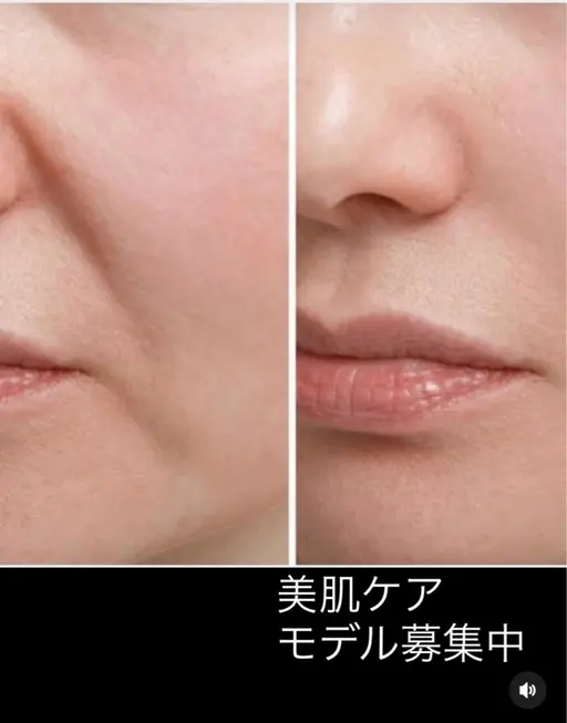 フェイスエステ