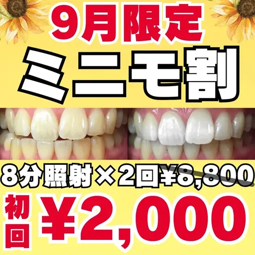 【🌻9月限定🌻ミニモ割🉐】8分照射×2回の痛くない❣食事制限なし✖お手軽セルフホワイトニングで理想の白い歯に☺️