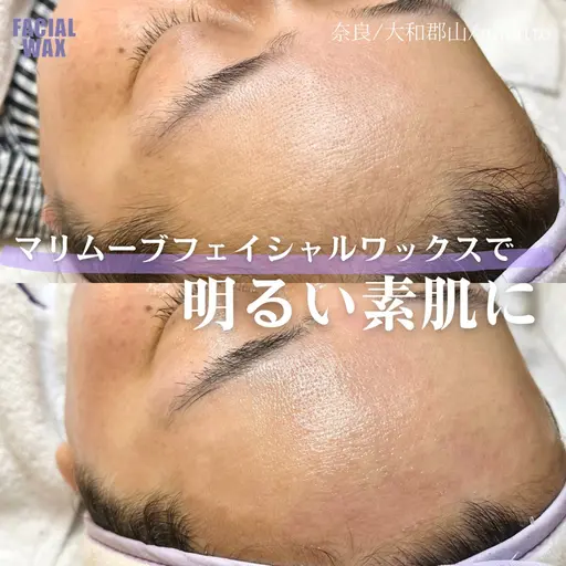 【記載の日時限定！✨】マリムーブフェイシャルワックス✨現金払いのみ⚠️