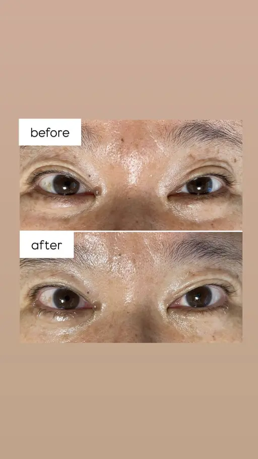 🌿【限定・練習モデル募集】ネトラバスティ👁️✨ 目元から癒しとデトックス
