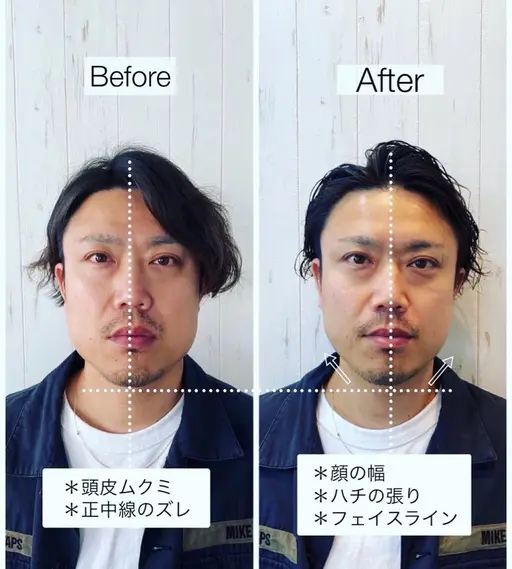 ✤モニター様限定✤ 骨格補正スパ+トリートメント