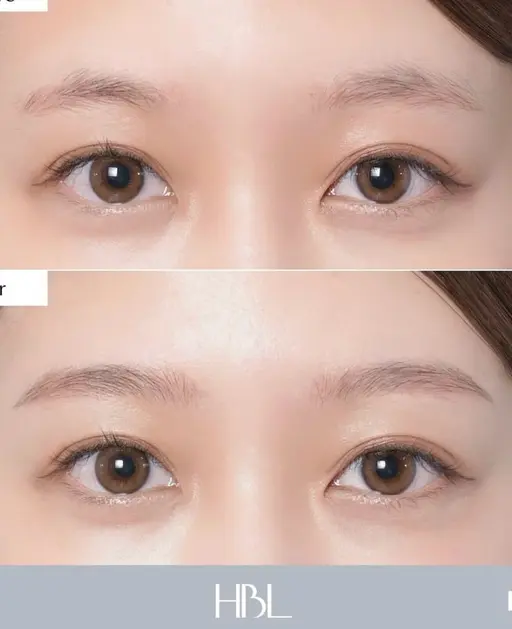 （16歳​〜​29歳限定）ハリウッドブロウリフト練習モデル