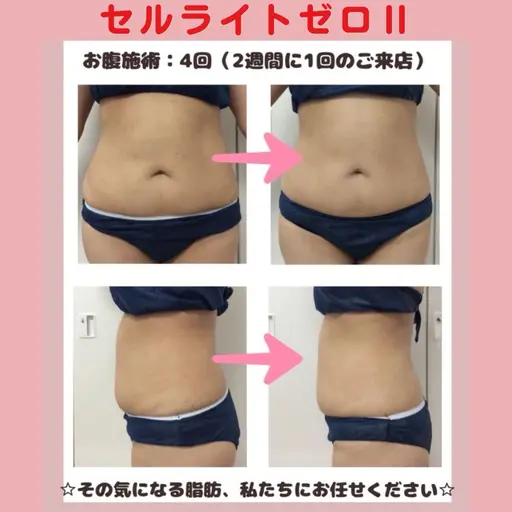 《5名様限定！》ぽっこりお腹が気になる方💦韓国式最新美容機器！お腹周り痩身＆デコルテ・肩周りリンパケアコース