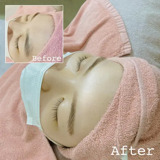 【お顔の脱毛】似合わせ額(おでこ)のうぶ毛をwax脱毛【ツヤん肌】【毛穴キュッ】【ニキビ肌の方にも必見】【赤ちゃん肌】