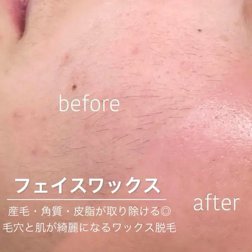 HBL➕Face Wax