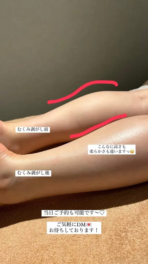 🦋全身オーダーメイドマッサージ🦋60min 【むくみ剥がし/コリ取り/ダイエット/骨格ケア】