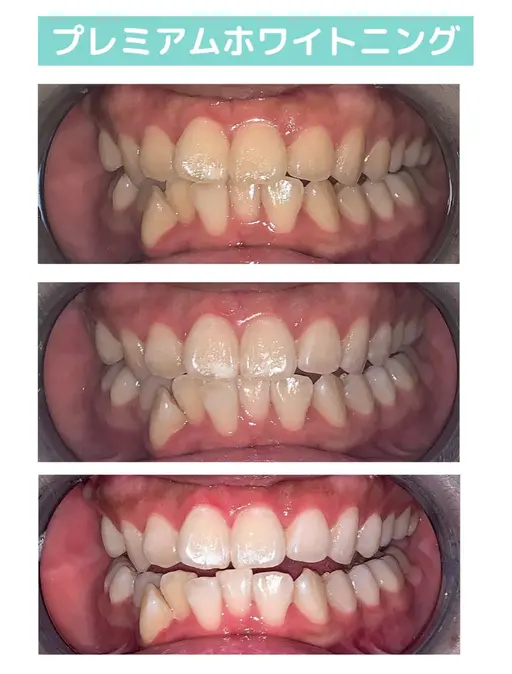 【期間限定メニュー】何と！会員級の合計60分照射！【2来店コース】