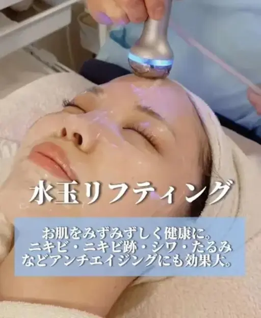 【ニキビケア】有名Youtuber御用達🍒国内希少なLDM水玉リフティング★根本肌質改善+肌診断