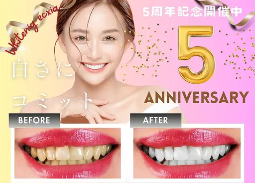 【当日限定】歯の黄ばみ・着色汚れ対策に◎セルフホワイトニング(9分2セット)1回¥3980→
