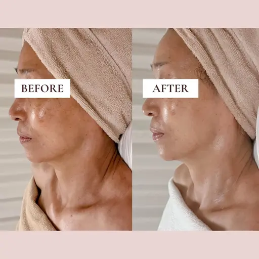 【痛みゼロ小顔ケア✨】輪郭すっきり🪞インディバフェイシャル90分💐